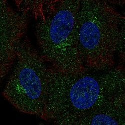 Invitrogen GALNT4 Polyclonal Antibody 100 &mu;L; Unconjugated:Antibodies,