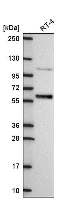 Invitrogen IRF6 Polyclonal Antibody 100 &mu;L; Unconjugated:Antibodies,