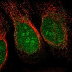 Invitrogen CHD3 Polyclonal Antibody 100 &mu;L; Unconjugated:Antibodies,