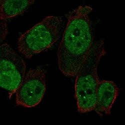 Invitrogen RAPGEF5 Polyclonal Antibody 100 &mu;L; Unconjugated:Antibodies,