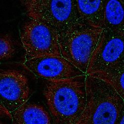 Invitrogen PCDHA11 Polyclonal Antibody 100 &mu;L; Unconjugated:Antibodies,
