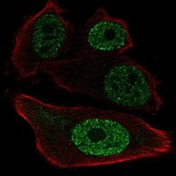 Invitrogen ETV1 Polyclonal Antibody 100 &mu;L; Unconjugated:Antibodies,