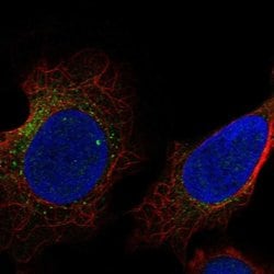 Invitrogen USP27X Polyclonal Antibody 100 &mu;L; Unconjugated:Antibodies,