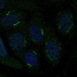 Invitrogen TMBIM4 Polyclonal Antibody 100 &mu;L; Unconjugated:Antibodies,