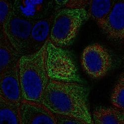 Invitrogen Adenylate Cyclase 5 Polyclonal Antibody 100 &mu;L; Unconjugated:Antibodies,