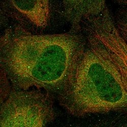 Invitrogen CK2 alpha-2 Polyclonal Antibody 100 &mu;L; Unconjugated:Antibodies,