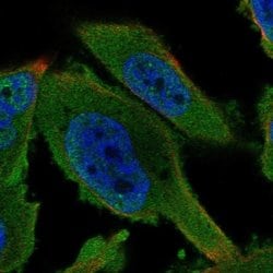 Invitrogen AMPK gamma-1 Polyclonal Antibody 100 &mu;L; Unconjugated:Antibodies,