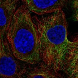 Invitrogen KRT80 Polyclonal Antibody 100 &mu;L; Unconjugated:Antibodies,