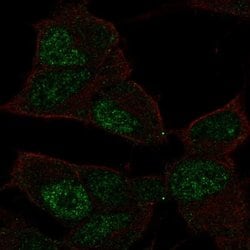 Invitrogen TCF9 Polyclonal Antibody 100 &mu;L; Unconjugated:Antibodies,