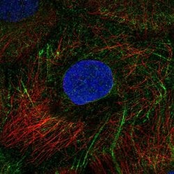 Invitrogen KRT80 Polyclonal Antibody 100 &mu;L; Unconjugated:Antibodies,
