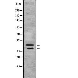 MSX1/MSX2 Polyclonal Antibody, Invitrogen 100 &mu;L | Buy Online | Invitrogen | Fisher Scientific