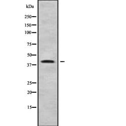B4GALT4 Polyclonal Antibody, Invitrogen 100 &mu;L | Buy Online | Invitrogen | Fisher Scientific