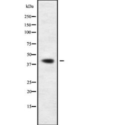 GMDS Polyclonal Antibody, Invitrogen 100 &mu;L; Unconjugated:Antibodies,