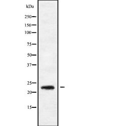 RAB9B Polyclonal Antibody, Invitrogen 100 &mu;L; Unconjugated:Antibodies,