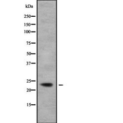 TCEAL5 Polyclonal Antibody, Invitrogen 100 &mu;L; Unconjugated:Antibodies,