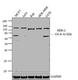 Invitrogen ErbB2 (HER-2) Polyclonal Antibody 500 &mu;L; Unconjugated:Antibodies,