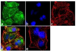 MMP9 Polyclonal Antibody, Invitrogen 500 &mu;L; Unconjugated:Antibodies,