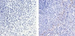 MMP9 Polyclonal Antibody, Invitrogen 500 &mu;L; Unconjugated:Antibodies,
