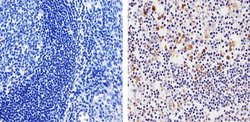 MMP9 Polyclonal Antibody, Invitrogen 500 &mu;L; Unconjugated:Antibodies,