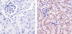 PDGFRA Polyclonal Antibody, Invitrogen 500 &mu;L; Unconjugated:Antibodies,