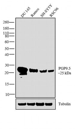 PGP9.5 Polyclonal Antibody, Invitrogen 500 &mu;L; Unconjugated:Anticuerpos