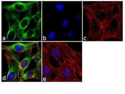 Invitrogen beta Tubulin Polyclonal Antibody 500 &mu;L; Unconjugated:Antibodies,