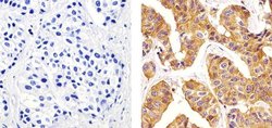 Invitrogen beta Tubulin Polyclonal Antibody 500 &mu;L; Unconjugated:Antibodies,