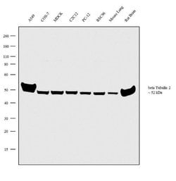 Invitrogen beta Tubulin 2 Polyclonal Antibody 100 &mu;L; Unconjugated:Antibodies,