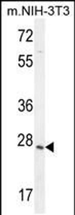 ZCCHC17 Rabbit anti-Human, Mouse, Polyclonal, Invitrogen 400 &mu;L; Unconjugated:Antibodies,