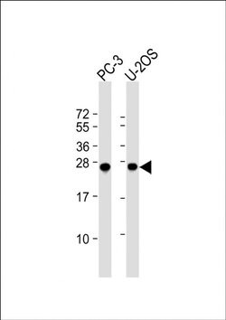 ZCCHC17 Rabbit anti-Human, Mouse, Polyclonal, Invitrogen 400 &mu;L; Unconjugated:Antibodies,