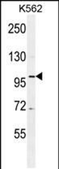 DDX27 Rabbit anti-Human, Polyclonal, Invitrogen 400 &mu;L; Unconjugated:Antibodies,