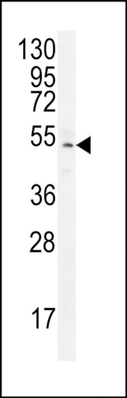 ZNF829 Rabbit anti-Human, Polyclonal, Invitrogen 400 &mu;L | Buy Online | Thermo Scientific | Fisher Scientific