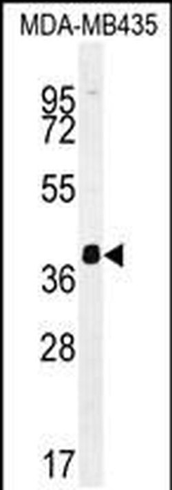 hnRNP CL1 Rabbit anti-Human, Polyclonal, Invitrogen 400 &mu;L; Unconjugated:Antibodies,