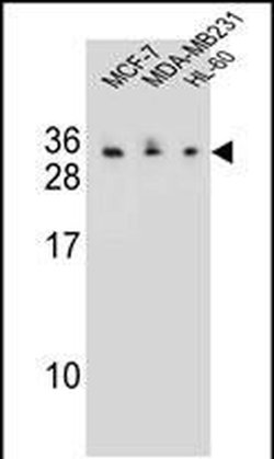 C1QL4 Rabbit anti-Human, Polyclonal, Invitrogen 400 &mu;L | Buy Online | Thermo Scientific | Fisher Scientific