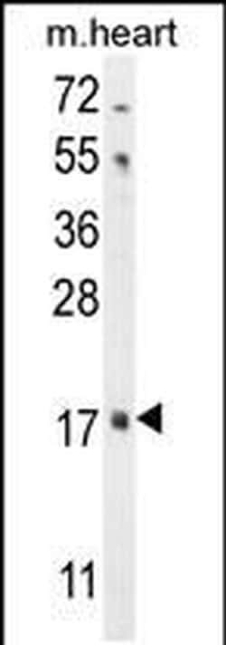 FGF16 Rabbit anti-Mouse, Polyclonal, Invitrogen 400 &mu;L; Unconjugated:Antibodies,