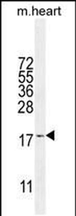 SNRNP27 Rabbit anti-Human, Mouse, Polyclonal, Invitrogen 400 &mu;L; Unconjugated:Antibodies,