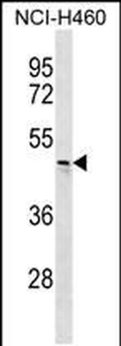 CHST6 Rabbit anti-Human, Polyclonal, Invitrogen 400 &mu;L; Unconjugated:Antibodies,