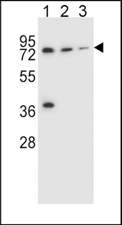 UGT2B15 Rabbit anti-Human, Polyclonal, Invitrogen 400 &mu;L; Unconjugated:Antibodies,