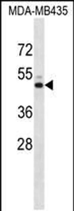 Kir7.1 (KCNJ13) Rabbit anti-Human, Polyclonal, Invitrogen 400 &mu;L; Unconjugated:Antibodies,