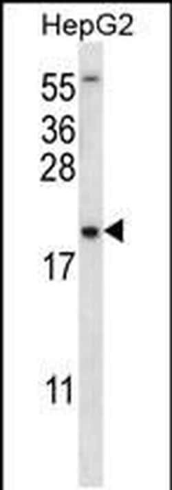 UBE2NL Rabbit anti-Human, Polyclonal, Invitrogen 400 &mu;L; Unconjugated:Antibodies,