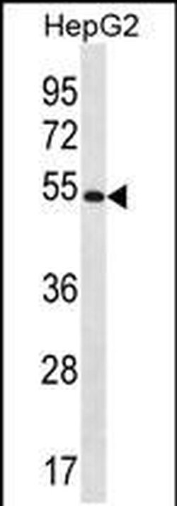 MGAT4C Rabbit anti-Human, Polyclonal, Invitrogen 400 &mu;L; Unconjugated:Antibodies,