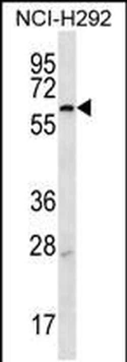 MBTPS2 Rabbit anti-Human, Polyclonal, Invitrogen 400 &mu;L; Unconjugated:Antibodies,