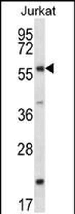 FOXJ3 Rabbit anti-Human, Polyclonal, Invitrogen 400 &mu;L; Unconjugated:Antibodies,