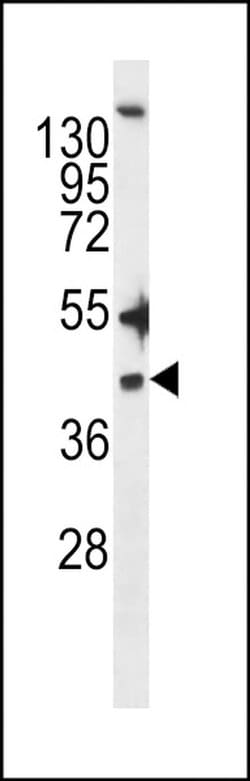 ZDHHC20 Rabbit anti-Human, Polyclonal, Invitrogen 400 &mu;L; Unconjugated:Antibodies,
