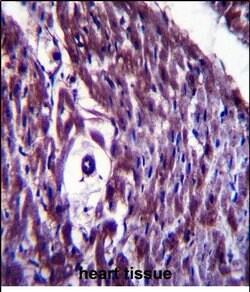 MAGED4 Rabbit anti-Human, Polyclonal, Invitrogen 400 &mu;L; Unconjugated:Antibodies,