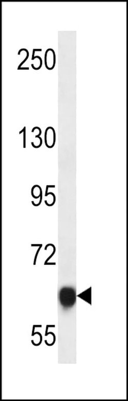 MAGED4 Rabbit anti-Human, Polyclonal, Invitrogen 400 &mu;L; Unconjugated:Antibodies,