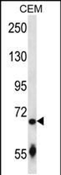 SLC27A3 Rabbit anti-Human, Polyclonal, Invitrogen 400 &mu;L; Unconjugated:Antibodies,
