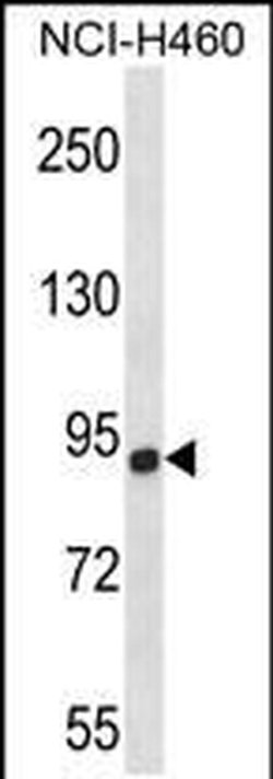 CHSY1 Rabbit anti-Human, Mouse, Polyclonal, Invitrogen 400 &mu;L; Unconjugated:Antibodies,