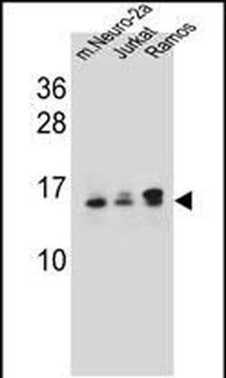 UBE2E2 Polyclonal Antibody, Invitrogen 400 &mu;L; Unconjugated:Antibodies,