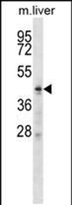 ZDHHC6 Rabbit anti-Human, Mouse, Polyclonal, Invitrogen 400 &mu;L; Unconjugated:Antibodies,